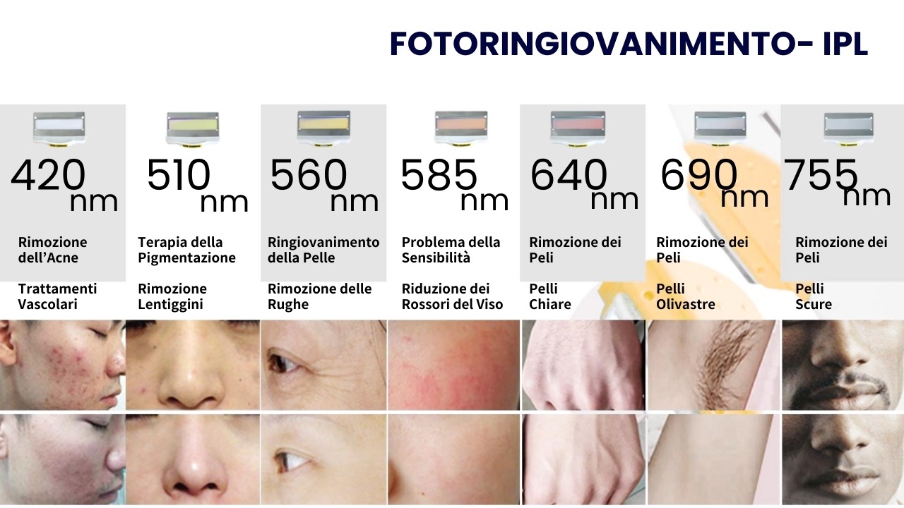 Trattamenti estetici con luce IPL