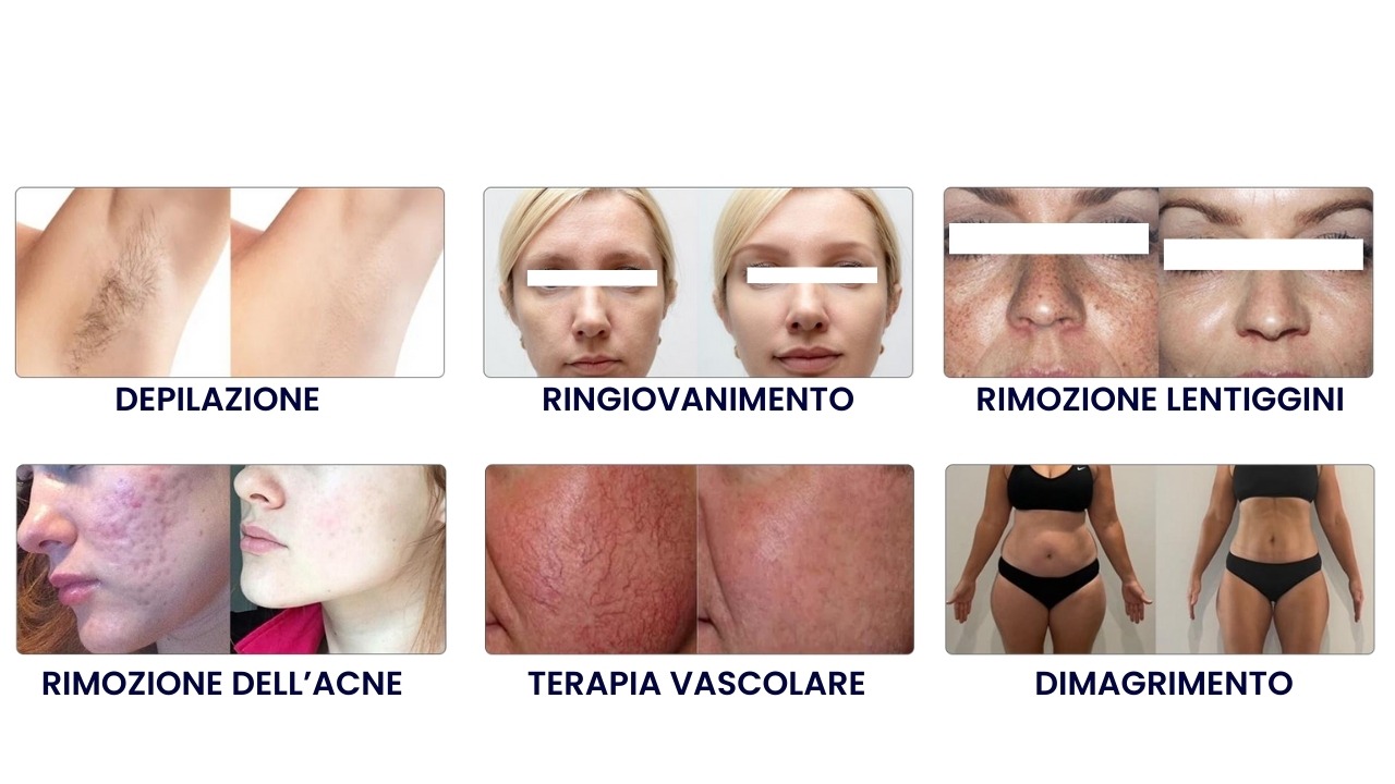 (Italiano) (12)